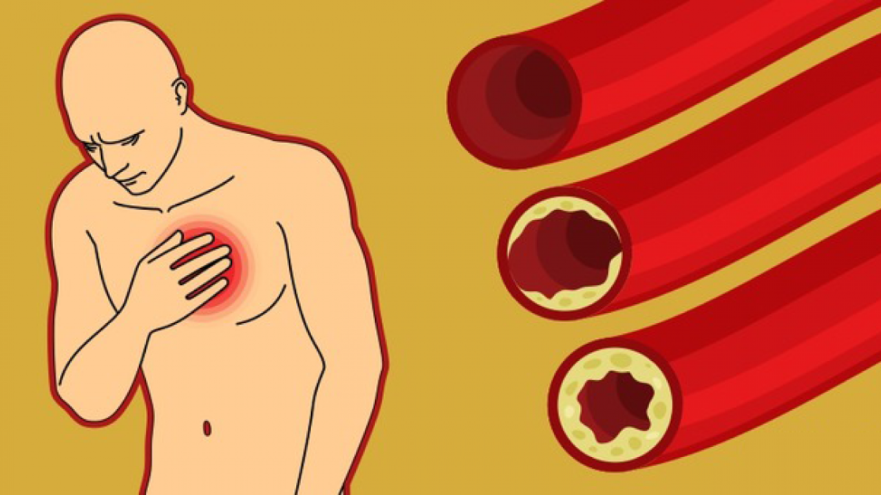 priemonės kraujagyslėms valyti nuo hipertenzijos