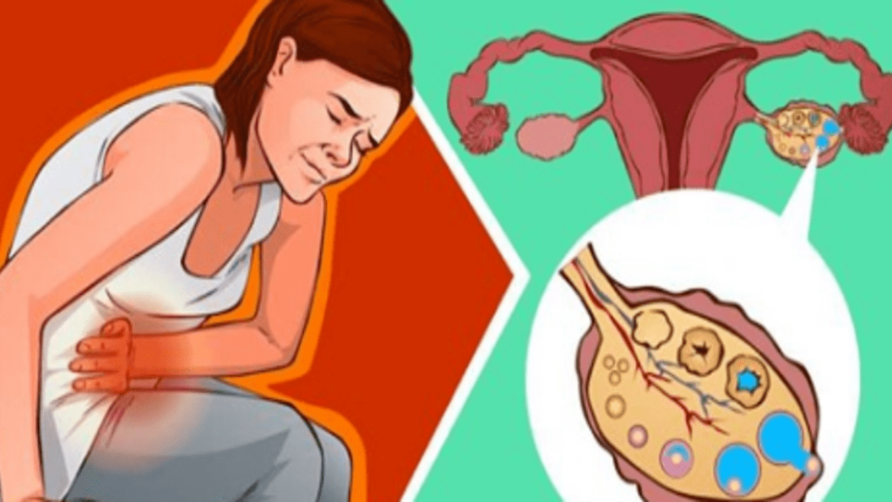 Peruse Tom Audreath Compound Sužinokite priežastis, dėl kurių jums gali skaudėti ovuliacijos metu