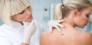 6 svarbūs faktai apie odos vėžį, kurie gali išgelbėti gyvybę
