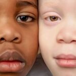 Skirtingų odos spalvų dvyniai nustebino net savo motiną