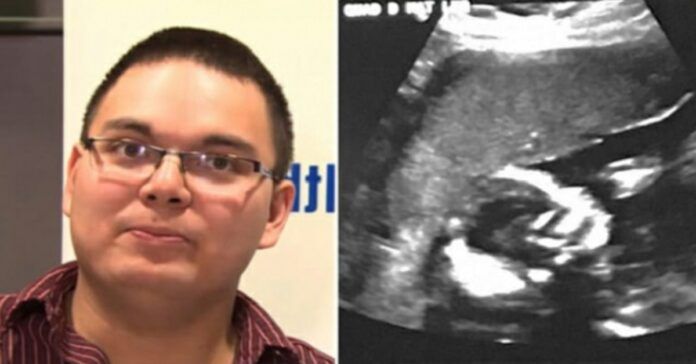 Vyras vos nenualpo, kai pamatė nėščios žmonos ultragarso nuotrauką