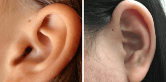 Ar žinojote, kodėl kai kurie žmonės ausyse turi skylutes?
