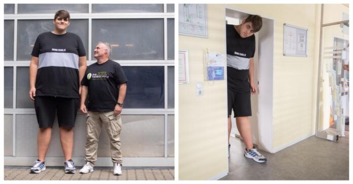 19-metis milžinas Kaip gyvena, 224 centimetrų ūgio vaikinas?