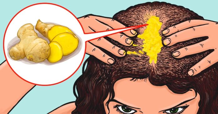 Natūralūs būdai, kaip sustabdyti plaukų slinkimą ir išvengti nuplikimo