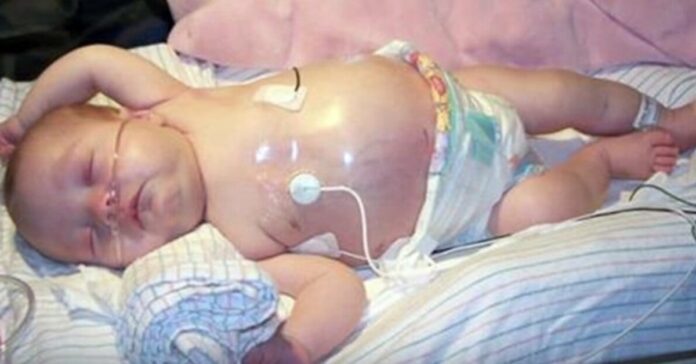 Gydytojas pamatė, kad dvynių kūdikių skrandyje kažkas auga. Kuo visa tai baigėsi?
