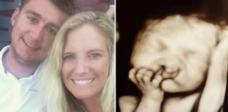 Tėvai atsisakė darytis abortą, nors vaisius buvo „apsigimęs“. Pažiūrėkite, kaip jų sūnus atrodo po 2 metų!