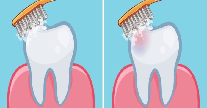 Kada geriausia valytis dantis? Odontologų atsakymas