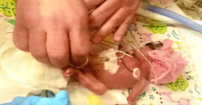 Kūdikis gimė 2 dienos po ribos, po kurios nebedaromi abortai. Ar jam pavyko išgyventi?