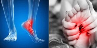 Pagrindinės pėdų skausmo rūšys, kurių negalima ignoruoti