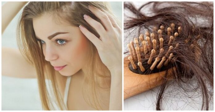 Kaip nustatyti, ar jums išslenka ne per daug plaukų?