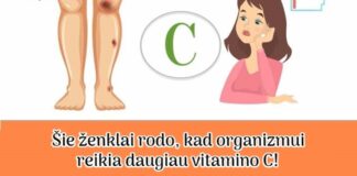 7 ženklai, kad jūsų organizmui reikia daugiau vitamino C!