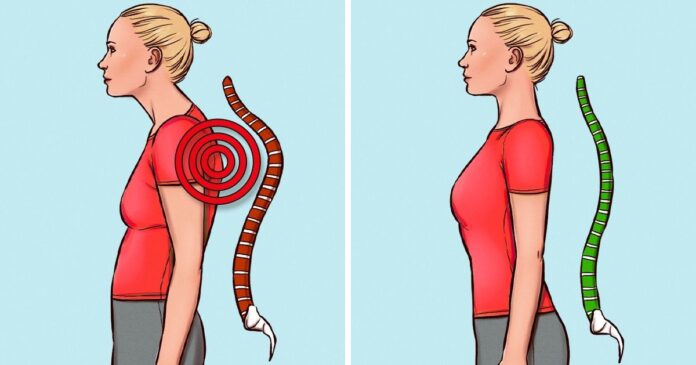 Pratimai, skirti prastai laikysenai ištaisyti ir nugaros bei kaklo skausmams panaikinti