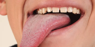Visata perspėja apie pavojų: ką atskleidžia jūsų liežuvis?